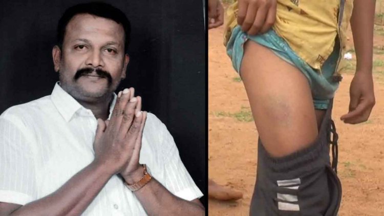 ಶಾಲಾ ಮಕ್ಕಳ ಮೇಲೆ ಪಾನಮತ್ತನಿಂದ ಮಾರಣಾಂತಿಕ ಹಲ್ಲೆ