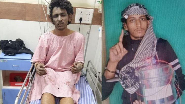 ಮಂಗಳೂರು ಕುಕ್ಕರ್ ಬಾಂಬ್ ಕೇಸ್ ಆರೋಪಿ ಶಾರೀಕ್ಗೆ ಇಂದು ಶಸ್ತ್ರಚಿಕಿತ್ಸೆ