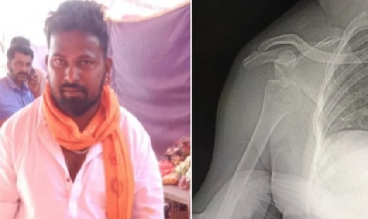 ಚಿಕ್ಕಮಗಳೂರಲ್ಲಿ ಬಿಜೆಪಿ ಕಾರ್ಯಕರ್ತನ ಮೇಲೆ ಮಾರಣಾಂತಿಕ ಹಲ್ಲೆ: ಗಂಭೀರ ಗಾಯ